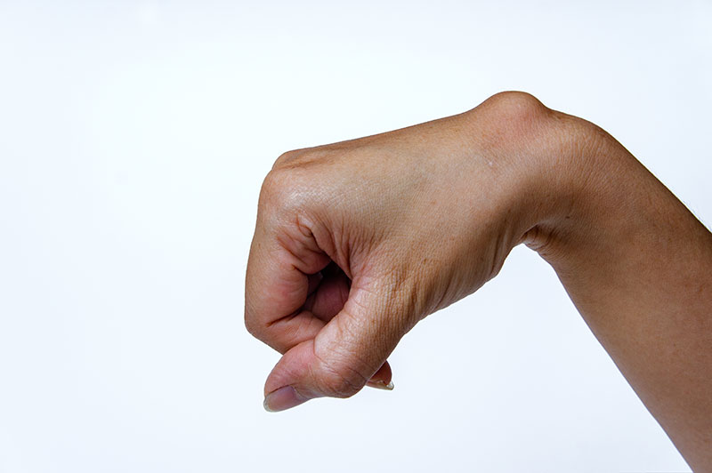 Ganglion Cysts Brooklyn Premier Orthopedics